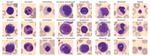 Optimizing Blood Cell Classification with Convolutional Neural Networks
